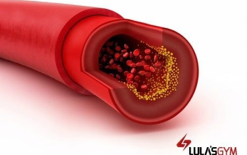 El colesterol en sangre. ¿ Bueno o malo?